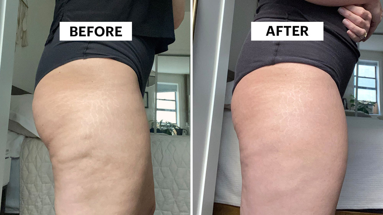 Sculpted skin without expensive clinical fees